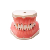 E05 – модель верхней и нижней челюсти для пародонтологической практики | GF Dental (Италия) 