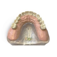 T12 – демонстрационная модель верхней челюсти с имплантами | GF Dental (Италия)
