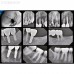 IOX1 - интраоральный визиограф, размер 1 | Dentium (Ю.Корея)