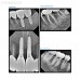 IOX1 - интраоральный визиограф, размер 1 | Dentium (Ю.Корея)