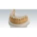Ceramill Splintec - прозрачный PMMA пластик для производства терапевтических кап | Amann Girrbach AG (Австрия)