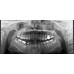 RAYSCAN Symphony Alpha M3DL – томограф 3 в 1: ортопантомограф и цефалостат (OneShot) 33х33 см, компьютерный томограф 3D 9х9 см | Ray Co., Ltd. (Ю. Корея)