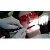 Anesto RA-5 - система внутрикостной анестезии | W&H DentalWerk (Австрия)
