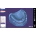 Exocad Full Denture Module - модуль для создания полносъемных протезов | Exocad (Германия)
