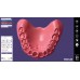 Exocad Full Denture Module - модуль для создания полносъемных протезов | Exocad (Германия)