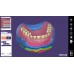Exocad Full Denture Module - модуль для создания полносъемных протезов | Exocad (Германия)