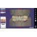 Exocad Full Denture Module - модуль для создания полносъемных протезов | Exocad (Германия)
