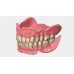 Exocad Full Denture Module - модуль для создания полносъемных протезов | Exocad (Германия)
