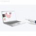 Launca DL-300 Wireless - беспроводной интраоральный сканер | Launca (Китай)