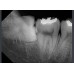 RIOSensor RIS500 - цифровой радиовизиограф, размер 2 | Ray Co., Ltd. (Ю. Корея)
