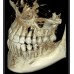RAYSCAN Symphony Alpha 3D - ортопантомограф с компьютерным томографом, 3D 9х9 см | Ray Co., Ltd. (Ю. Корея)