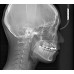 RAYSCAN Symphony Alpha 3D - ортопантомограф с компьютерным томографом, 3D 9х9 см | Ray Co., Ltd. (Ю. Корея)