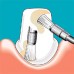 Sonicflex clean A - набор насадок и щетки Sono для профессиональной механической чистки зубов (снятия зубных отложений) | KaVo (Германия)