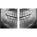RAYSCAN Symphony Alpha OCL – ортопантомограф c цефалостатом (One Shot), 33х33 см | Ray Co., Ltd. (Ю. Корея)