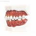 Модель верхней и нижней челюсти с различными патологиями | Dentalstore (Италия)