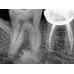 Kodak RVG 5200 - радиовизиограф, 16 пар линий/мм | Carestream Dental (США)
