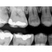 Kodak RVG 5200 - радиовизиограф, 16 пар линий/мм | Carestream Dental (США)