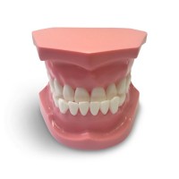 ORB04 – ортодонтическая модель с брекетами и твердой десной | GF Dental (Италия) 