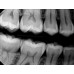 Kodak RVG 6200 - радиовизиограф, 24 пар линий/мм | Carestream Dental (США)