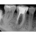 Kodak RVG 6200 - радиовизиограф, 24 пар линий/мм | Carestream Dental (США)