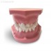 ORB02 – ортодонтическая модель с брекетами и твердой десной, 1 класс | GF Dental (Италия) 