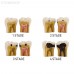 TOOTH MODEL W-TYPE - модель из 4-х зубов, демонстрирующая стадии кариеса | Hanil (Ю. Корея)