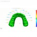 Aoralscan 3 - интраоральный сканер | Shining 3D (Китай)