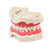 E03 – модель верхней и нижней челюсти для практики | GF Dental (Италия)