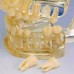 Study Model Transparent - прозрачная демонстрационная модель челюсти высокого качества | Hager & Werken (Германия)