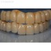 G5 - комбинированный 5-ти осевой станок для влажной обработки | Dental Machine (Италия)