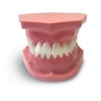 ORB03 – ортодонтическая модель с брекетами и твердой десной, 2 класс | GF Dental (Италия) 