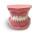 ORB03 – ортодонтическая модель с брекетами и твердой десной, 2 класс | GF Dental (Италия) 