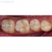 Smile Lite MDP - подсветка для дентальной фотографии, для смартфона | Smile Line (Швейцария)