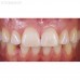 Smile Lite MDP - подсветка для дентальной фотографии, для смартфона | Smile Line (Швейцария)