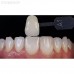 Smile Lite MDP - подсветка для дентальной фотографии, для смартфона | Smile Line (Швейцария)