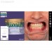 Exocad Smile Creator - модуль для планирования улыбки | Exocad (Германия)
