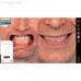 Exocad Smile Creator - модуль для планирования улыбки | Exocad (Германия)