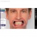 Exocad Smile Creator - модуль для планирования улыбки | Exocad (Германия)