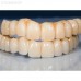 Vector Loader Disk System - комбинированный 5-осевой фрезерный станок с чейнджером | Dental Machine (Италия)