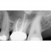 FONA CDR powered by SCHICK - система компьютерной стоматологической радиографии | FONA Dental s.r.o. (Италия)