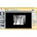 FONA CDR powered by SCHICK - система компьютерной стоматологической радиографии | FONA Dental s.r.o. (Италия)