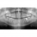 FONA Art Plus/Art Plus C - рентгенографическая цифровая система панорамной съемки | FONA Dental s.r.o. (Италия)