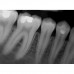Dr.Suni Plus - система компьютерной радиовизиографии | Suni Medical Imaging Inc. (США)