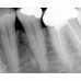 Dr.Suni Plus - система компьютерной радиовизиографии | Suni Medical Imaging Inc. (США)