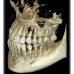 RAYSCAN Symphony Alpha Plus 120 SM3D - ортопантомограф с цефалостатом 26х24 см и компьютерным томографом 3D (4х12)*(3х10) см | Ray Co., Ltd. (Ю. Корея)